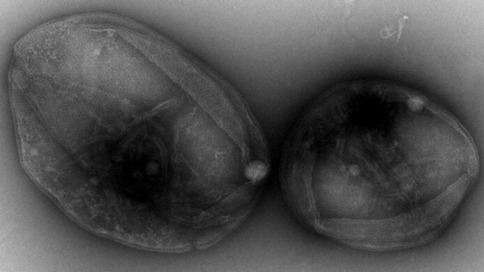 Mikroorganismus Sulfolobus acidocaldarius unter dem Mikroskop